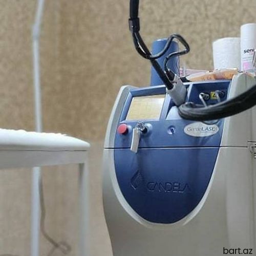  Lazer aparatları satılır